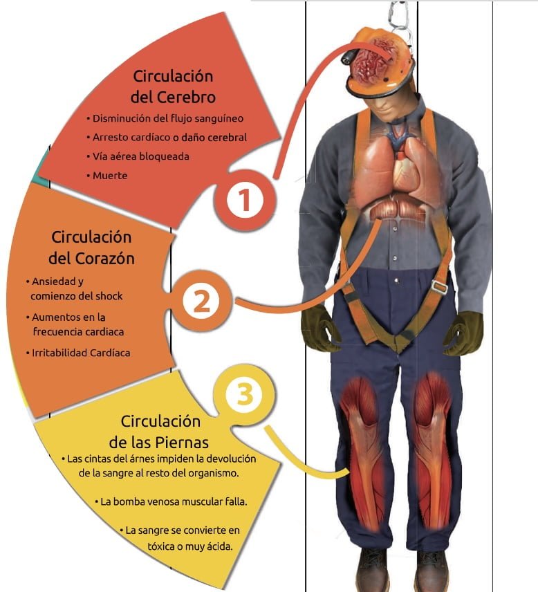 Síndrome de Arnés